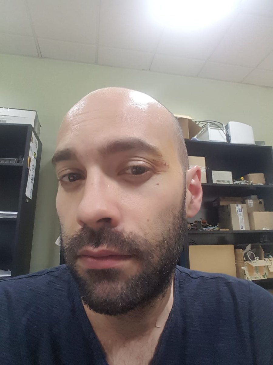 CDLaPinza's tweet photo. Nos complace anunciar que el creador de "La pinza", un incansable tanto dentro como fuera de la pista, @danypermon aportará un año más todo su talento y tesón en la cancha.
Los aros y tableros temblarán una temporada más cuando le vean aparecer, no se conoce un @CDLaPinza sin él. https://t.co/a5pbmLX6q7