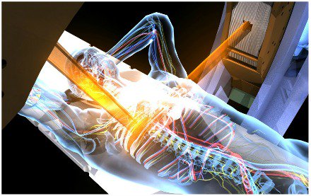 viewray's tweet photo. Webinar: 2 speakers will share their clinical experience with managing respiratory tumor motion via #MRIGuidedRT. Learn about precision radiation treatment using real-time image guidance during beam delivery. Sept. 20, 2pm ET. #MRLinac #RadOnc Register: https://t.co/oiNtsTIhOH https://t.co/WW3eulyMOR