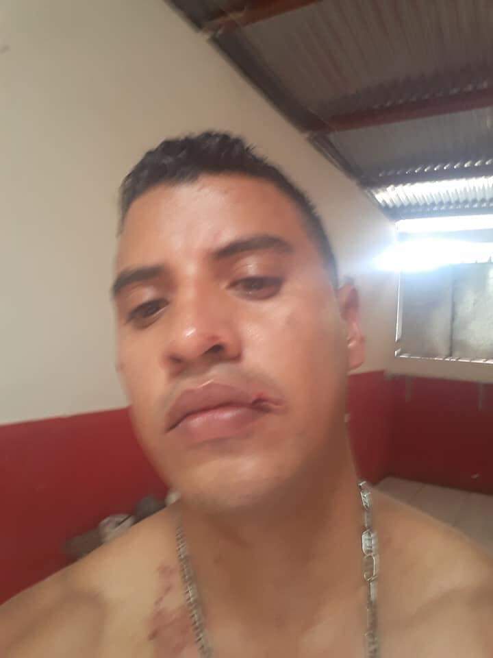 nicaraguainvest's tweet photo. El escultor leonés Helmut Bustos, quien hizo las esculturas en homenaje a Álvaro Conrado y Sandor Dolmus, dos niños asesinados por la policía dirigida por #Ortega fue golpeado hoy por un sujeto desconocido y sin saber las razones #NicaraguaInvestiga https://t.co/iXAld0en1G