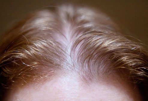 EYECANDY_SF's tweet image. Thinning hair is very common and happens to men and women. Now there is a treatment called #microscalppigmentation that helps conceal the thinning and give you the appearance of hair where was lacking before. Learn more here: ow.ly/Hwsl30kVN3x #SanFrancisco #SFsalon