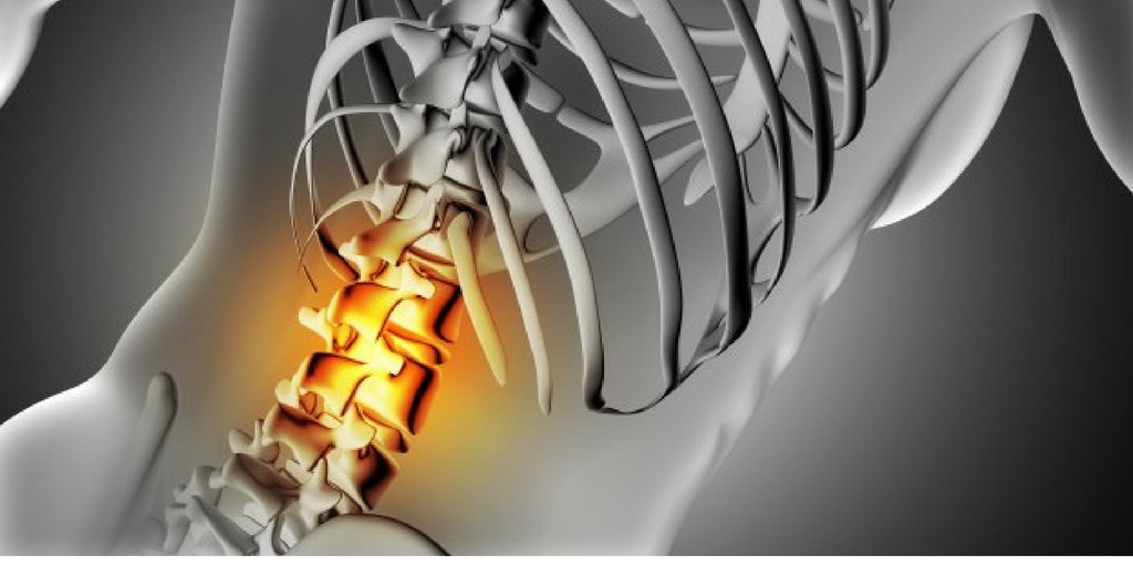 GoMediiOfficial's tweet image. एंकायलूजिंग स्पॉन्डिलाइटिस बीमारी क्या है जाने इसके लक्षण,कारण और उपचार #GoMedii #BackProblem 

goo.gl/Ru5rtW