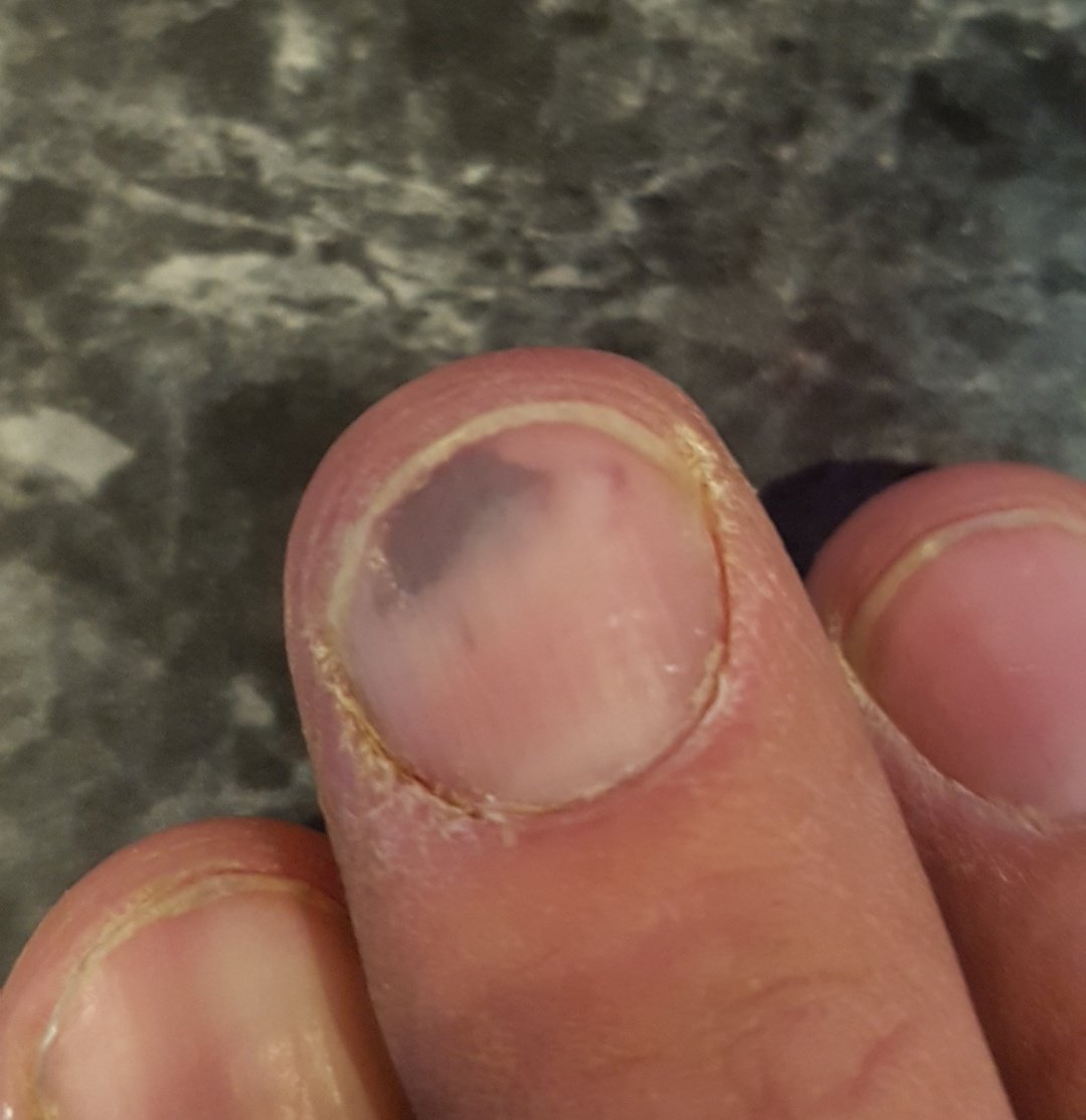 Yegpain Hashtag On Twitter