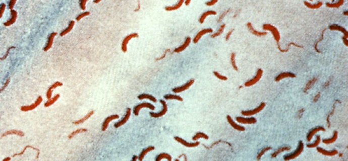 bacterialmeet's tweet image. Scientists think they may have discovered how V. #cholerae became a #humanpathogen, through its ability to interact with #amoebae in aquatic #environments.
bit.ly/2OHEDCg
mail me:  bacteriology@microbioconferences.com
#bacteriology #Infection #disease #antibitics