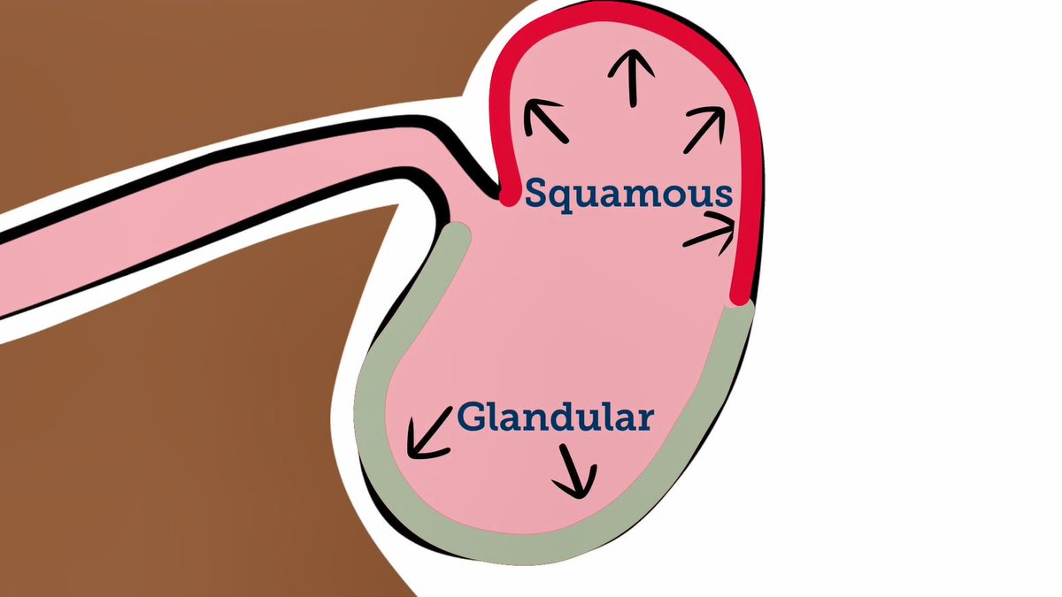 Have you seen our short animation explaining how horses can develop gastric ulcers? It also shares some management practices that you can follow to keep your horse happy and healthy. Watch it here: youtu.be/oYl1Hh7Bci0

#PoweredByProtexin