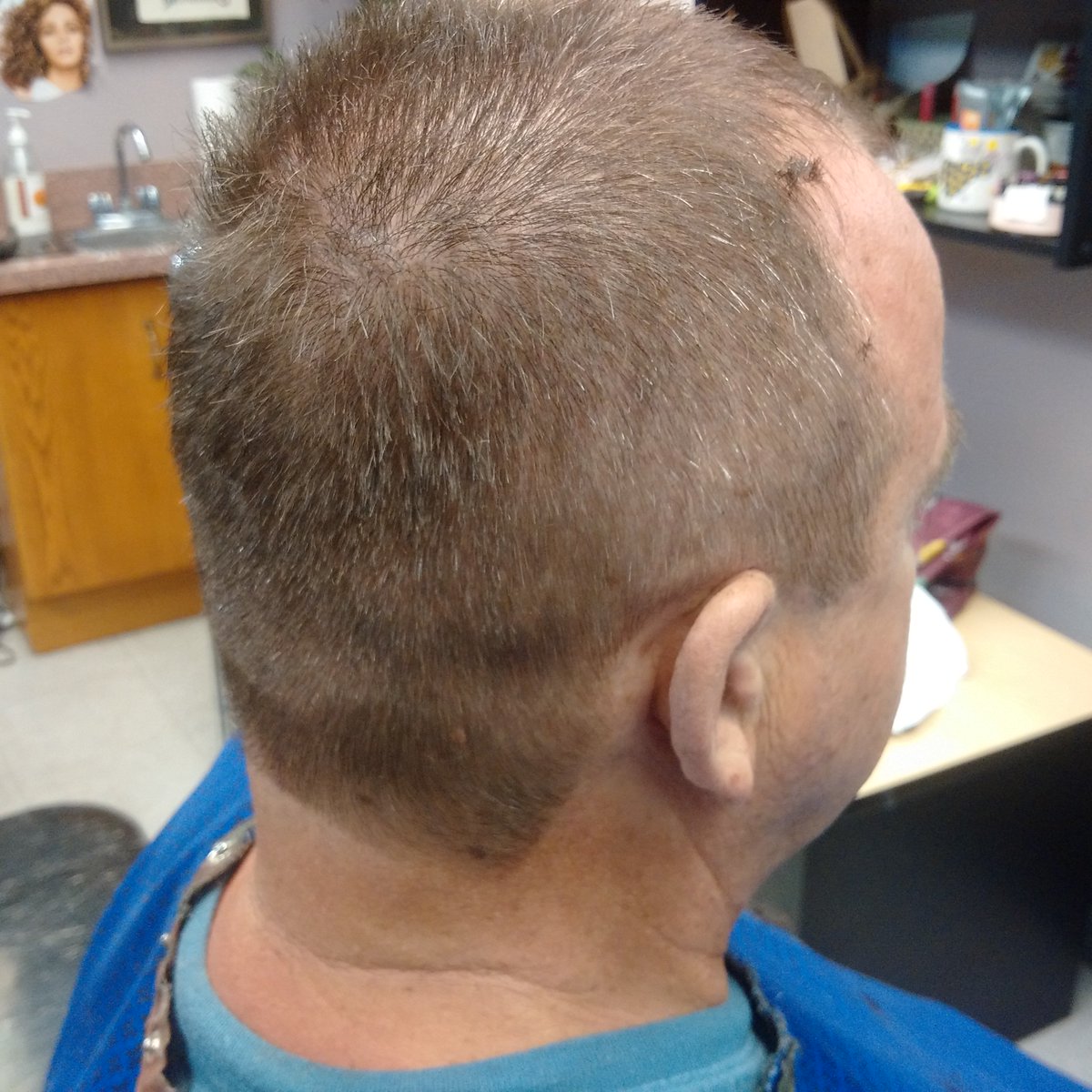Hairstudio1mn's tweet image. There is #pictures of #manClipperHaircut 
#scissorsonTop