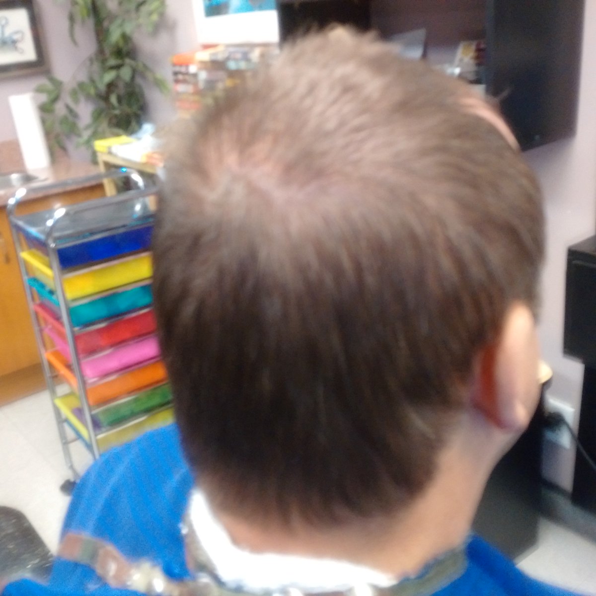 Hairstudio1mn's tweet image. There is #pictures of #manClipperHaircut 
#scissorsonTop