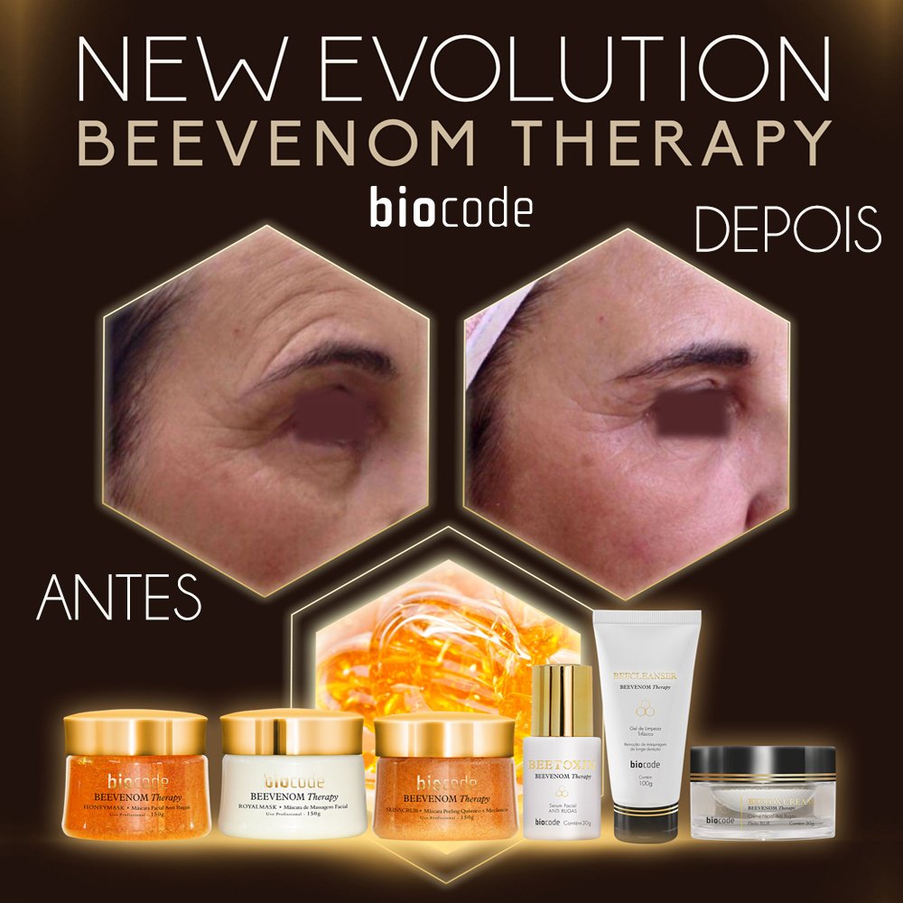 BiocodeCosmetic's tweet image. FUNCIONA MESMO
“TOXINA-Like”
preenchimento “injection-free”
peeling superficial
lifting antigravidade
#codigodabeleza #dermocosmeticos #biocodecosmetic #advancedskinformulas #preenchimento #peeling #lifting #beevenom #beevenomtherapy