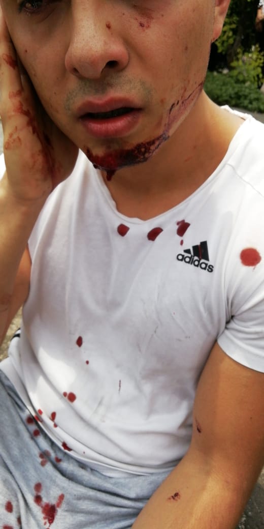 #Ahoramismo ciclista aventado por taxi en Eje Central. ¿Cuándo hacen ya trolebici <a href="/GerardoBaezP/">Gerardo Báez Pineda</a> ? Tienen 150 millones para esto desde 2015 <a href="/greenpeacemx/">Greenpeace México</a> <a href="/Bicitekas/">Bicitekas</a>