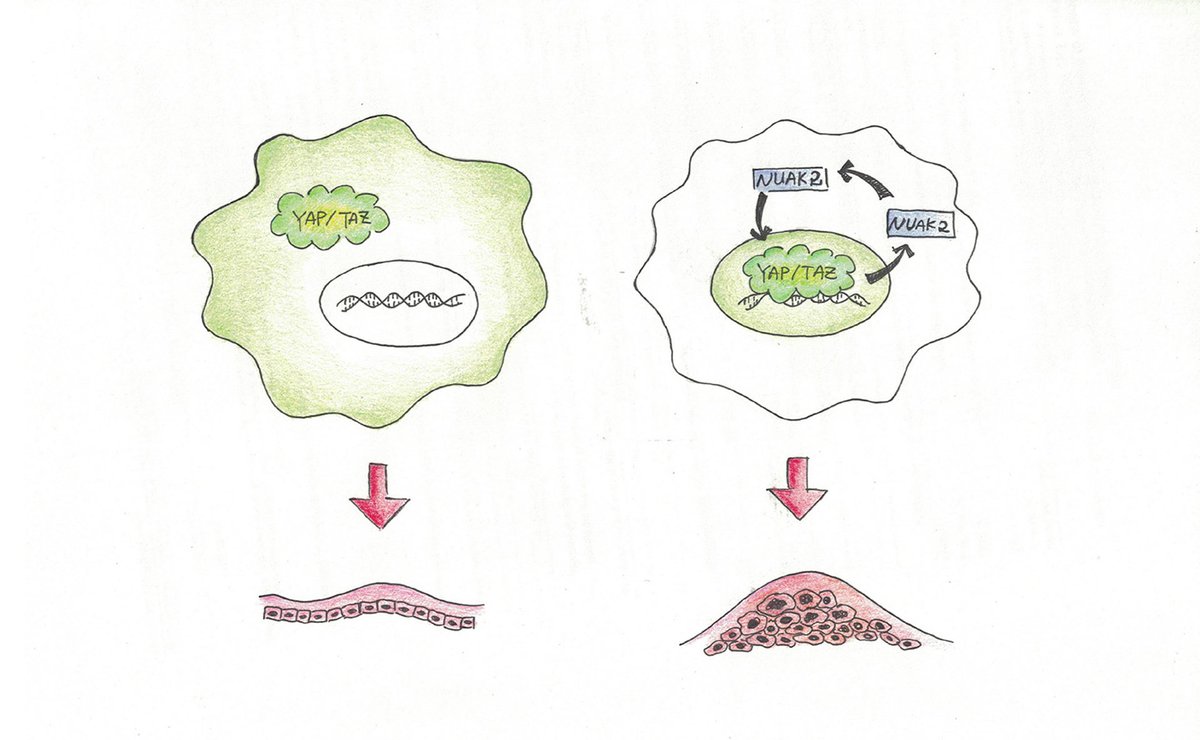 uoftmedicine's tweet photo. #UofT study @Nature reveals how some tumours fuel their own growth &amp; how stopping this vicious cycle could lead to new treatments https://t.co/AGa7mhotxm https://t.co/oMDggHWWFl