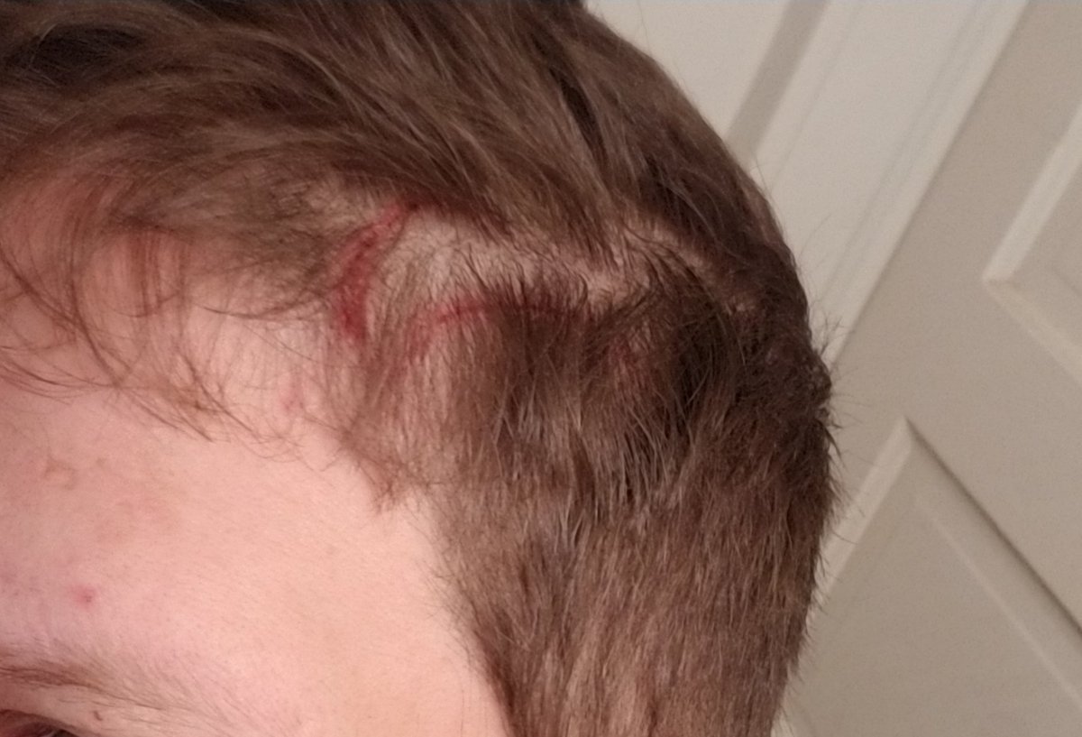 Here are some photos of the scratches I discovered after investigating. #demonic #paranormal #scary #demon #ghost