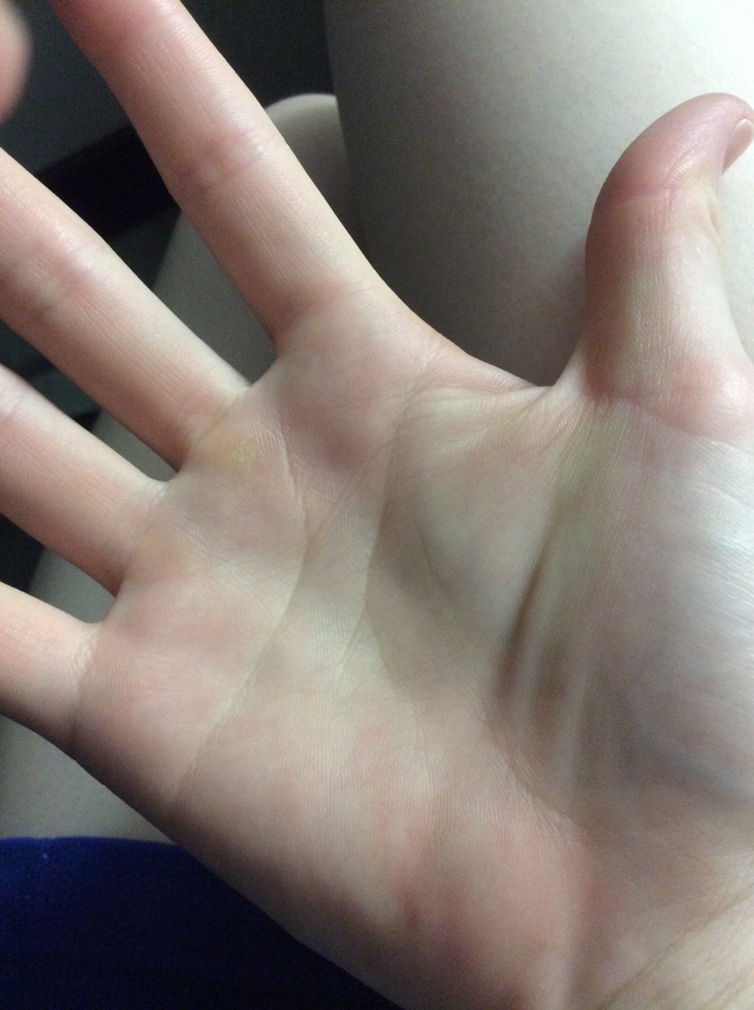 芹澤藍夢 手相の話なんですが 両手にますかけ線がある女性ってあんまりいないらしいんですよね 他に女性で両手にますかけ線あるよって人いたら教えてほしいです 手相 ますかけ線 T Co Onmw3z7fjw Twitter