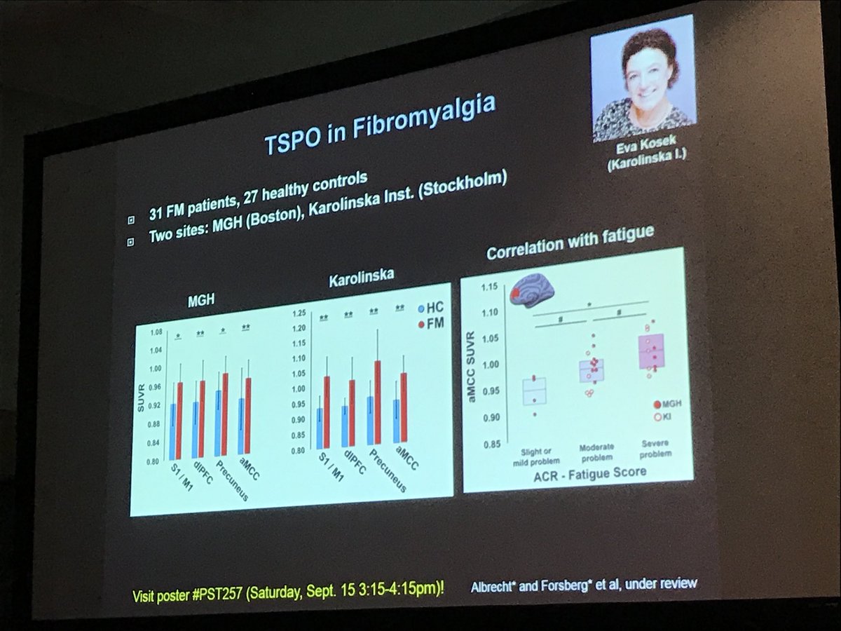 Lauren Heathcote, PhD (@lcheathcote) on Twitter photo What do you do when you find out another scientist is doing the same study as you? Team up and have an even better paper, of course! Awesome work <a href="/marcologgia1/">Marco Loggia</a> #IASPCongress What do you do when you find out another scientist is doing the same study as you? Team up and have an even better paper, of course! Awesome work <a href="/marcologgia1/">Marco Loggia</a> #IASPCongress