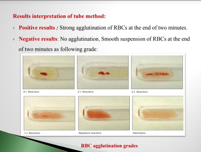 ملخص Blood Bank (بنك الدم )💉👩🏻‍🔬 Thread from غيداء طلال بصفر🇸🇦