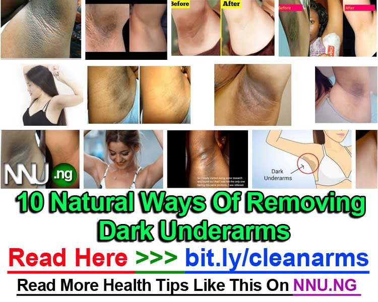 AfolabiJoseph's tweet photo. #NNU_Income - 10 Natural Ways Of Removing Dark Underarms - Read Here >>> https://t.co/Q9sngcTfIR https://t.co/nSxjx7mbM9