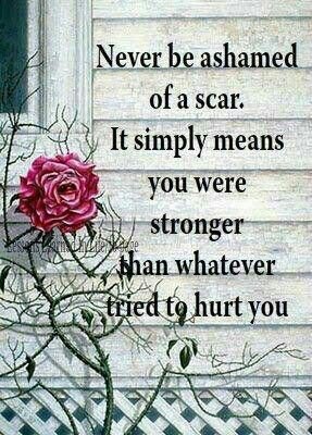 ifightlikealady's tweet photo. #Strong #beastmode #stillstanding https://t.co/Qxbms551om