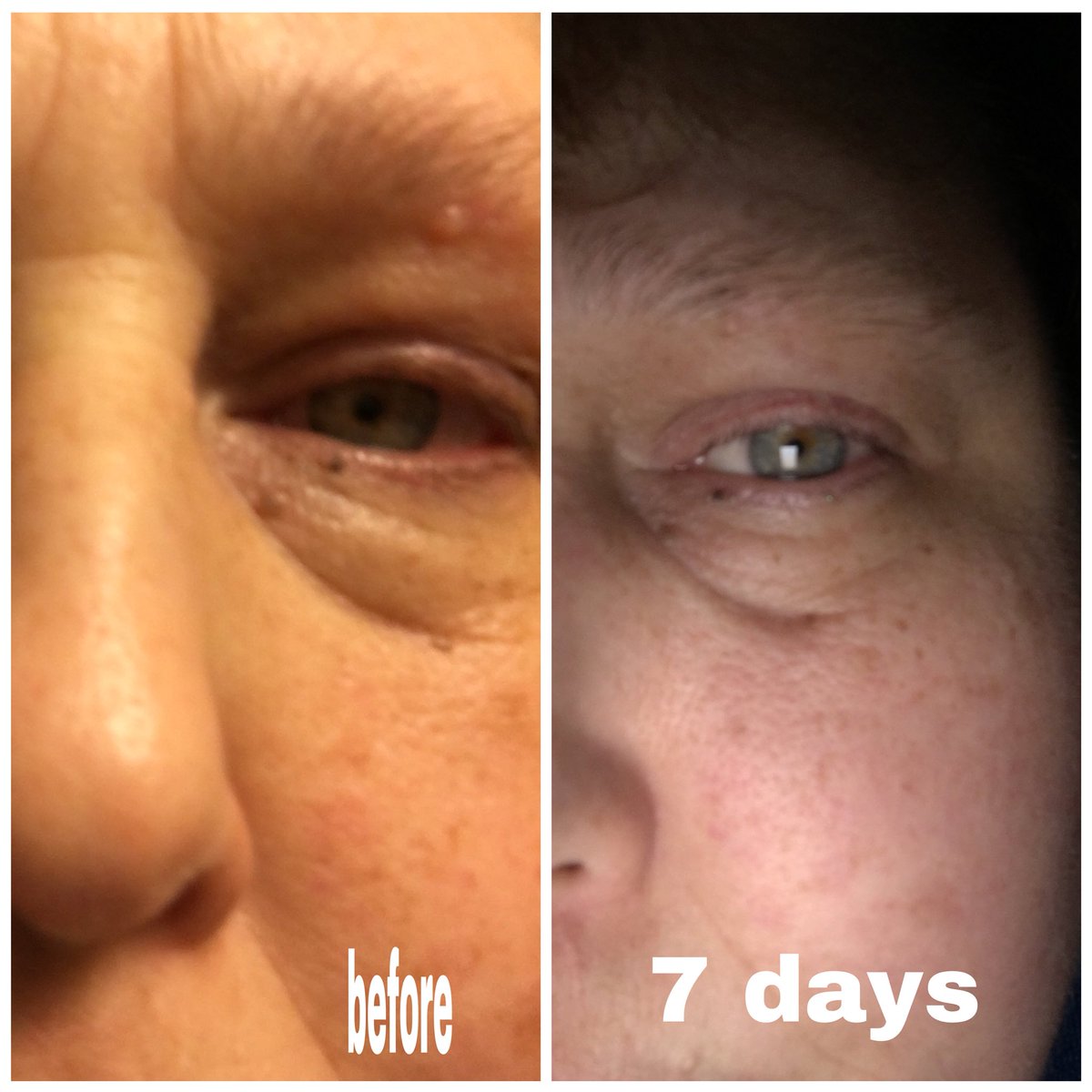 perricone md essential fx eye cream