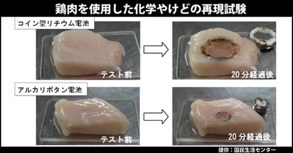 これは危険！！気を付けてwwボタン電池の破壊力はヤバい！！