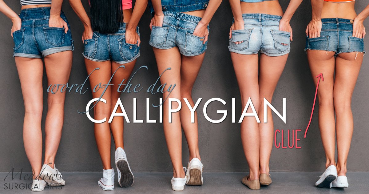 Callipygian