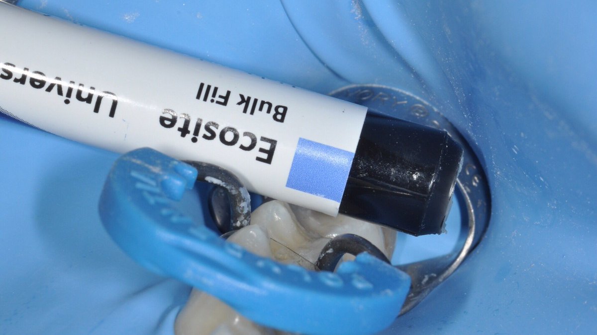 styleitaliano's tweet photo. Don’t miss latest article by dr. Anna Salat “Fillings made fast and easy” presenting a clinical case of our daily practice with composites in which the bulk-fill is used to restore a posterior tooth #aesthetic #dentistry @DMG_DentalNews @DMGAmerica https://t.co/sMpwbrBCnv https://t.co/CUugOB5E30
