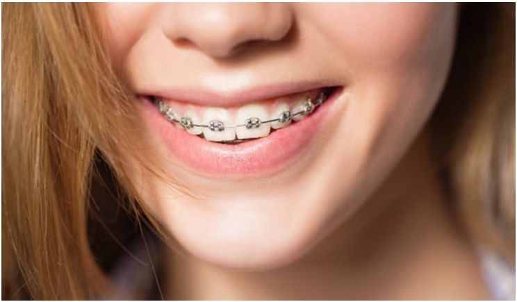 Give your patients the proper Orthodontic insight on what the right path may be based on their unique wants and needs.
dentistrytoday.com/news/todays-de…
#Clear #Orthodontics #ClearBraces #ClearAligners #Invisalign #Patients #Treatment