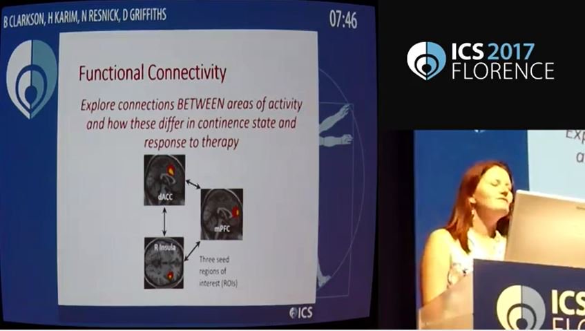 PittGeriMed's tweet photo. Check out Becky Clarkson, PhD @BeckyDawn13 last year at the International Continence Society Conference 2017. Stay tuned for this year's interview! #ICS2017 #urinary #incontinence https://t.co/u28CsTIBHz https://t.co/rfxDpJ5Wev