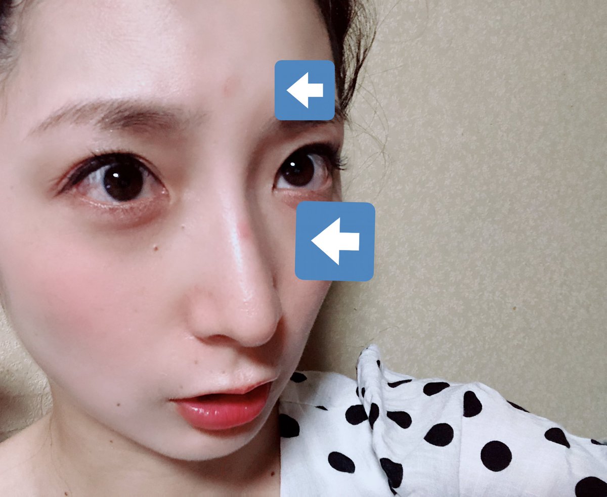 加野文華 浮かれたサングラスしたまま顔面クリームしたら怪我することがかのりんの顔面によって証明されました 皆さんも顔面クリームすると思いますのでその際は眼鏡を外すのをおすすめします