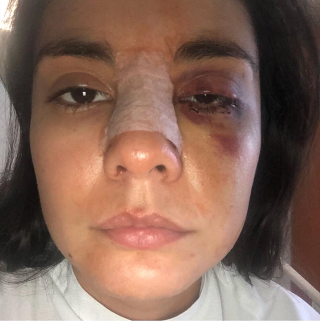 JulianRoman's tweet photo. Ella es @eileenmorenoact actriz colombiana que denuncia a su ex pareja el señor @alejandrogarciaactor quien la agredió salvajemente. Ella es Osada y valiente al denunciar. #niunamas https://t.co/XmYxg9ylgq