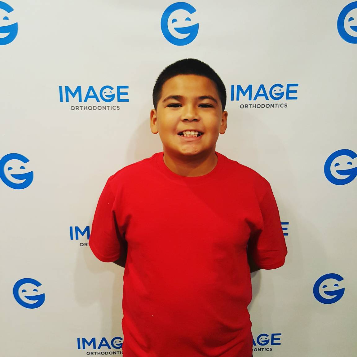 ImageOrthoCA's tweet image. Congratulations Juan on completing your first phase of Treatment! #imageorthosj #bracesoff #smilemakers