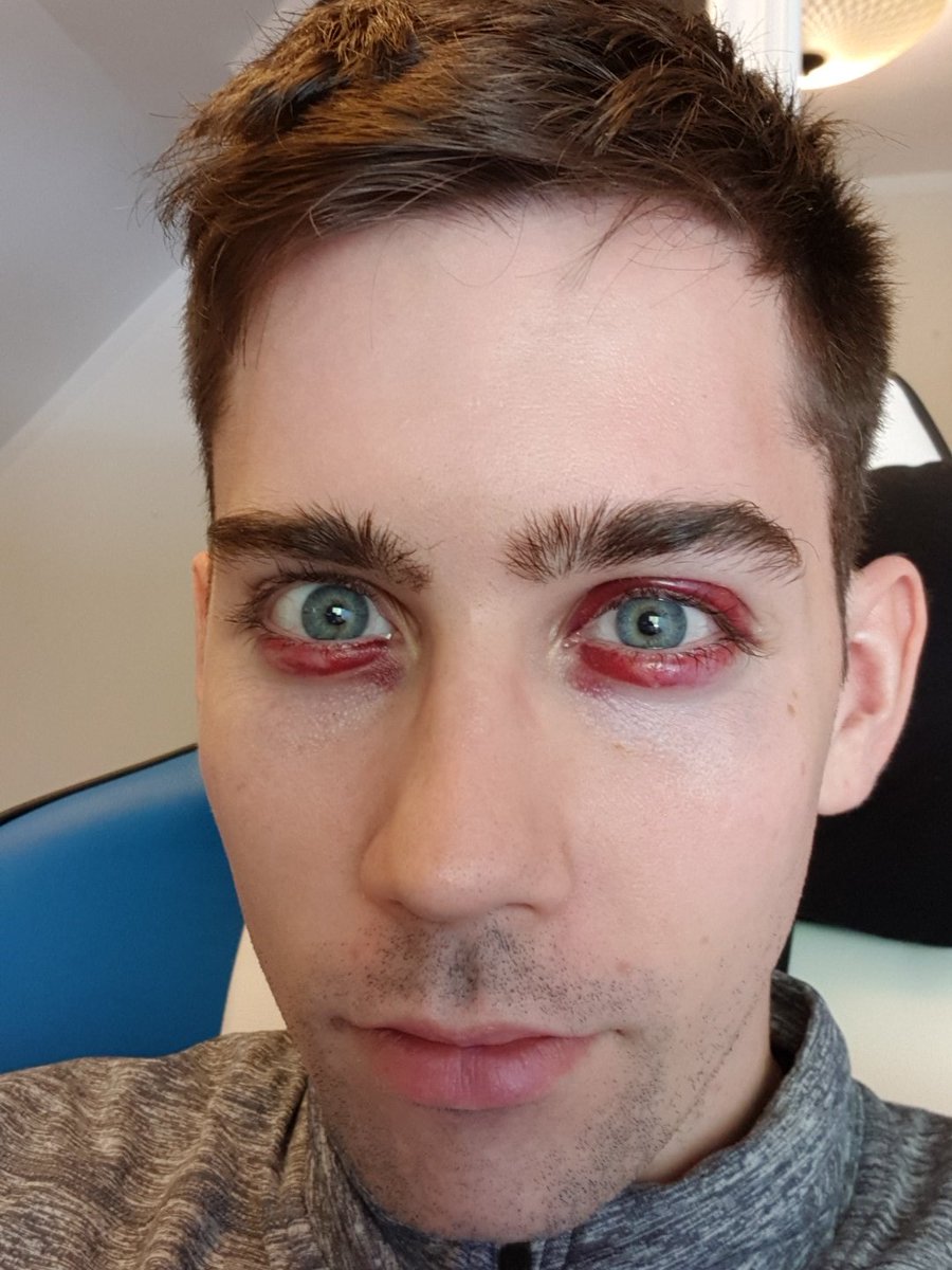 September equals break.

AND WHO would beat this poor boy up?