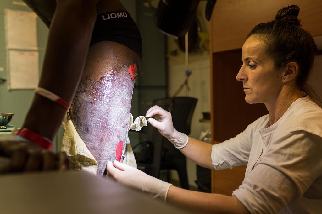 The toxic mix of salt water &amp; spilled fuel in rubber &amp; wooden boats causes these nasty &amp; very painful chemicals burns on survivors.  Women &amp; children are particularly vulnerable to being burned as they are often packed in the bottom of the boat for their perceived safety.