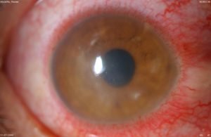 ReadyLifestyle's tweet photo. Can You Wear Contacts in a SHTF? – What Are the Risks If You Do? https://t.co/koSSpx8rEL #Prepping #SHTF #PostCollapseSHTF https://t.co/OKtULQMypD