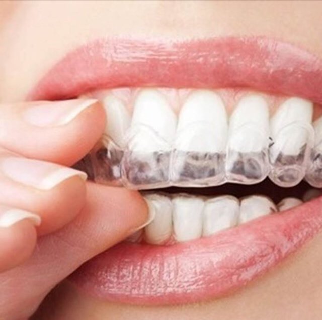 timplantedental's tweet photo. La #Ortodoncia Invisible es una Excelente Opción sin lucir Aparatos… Mira más aquí ►  https://t.co/Q2Y371uZBN
________
#Orthodontics #Dientes #Teeth #Tooth #Smile #PerfectSmile https://t.co/AK5ax07FaE