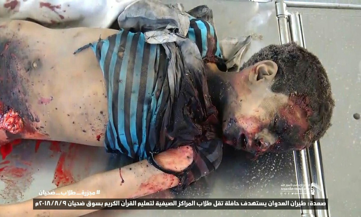 sultan87918's tweet photo. تحالف العدوان السعودي الأمريكي الساقط يقر رسميا بارتكابه جريمة أطفال #صعدة ويقول إنه يأسف لوقوع أخطاء في الغارة على حافلة صعدة زاعما انه سيحاسب من أسماهم بمرتكبيها ...

يارب انت المنتقم #حقوق_الانسان #اهلا_بالعام_الدراسي #حقوق_الطفل #السعودية #اليمن
عذراً لبشاعة المنظر https://t.co/ctycX0x8Xg