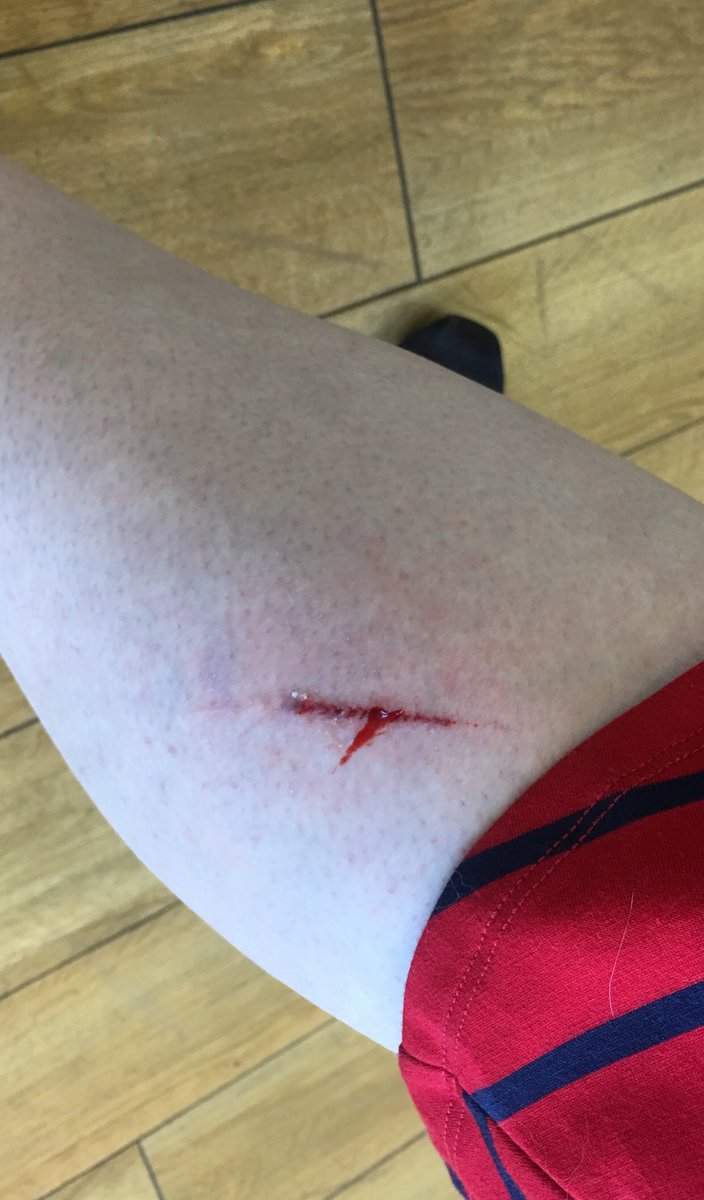 Went to <a href="/ultabeauty/">Ulta Beauty</a> to try <a href="/ICONICLDN/">ICONIC LONDON</a> and left a bloody mess 😢