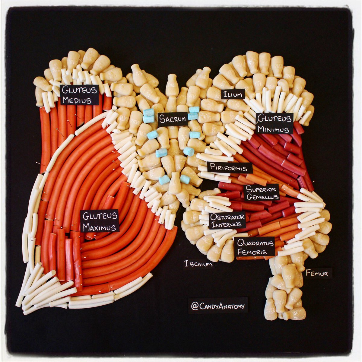CandyAnatomy's tweet photo. “Glucose Maximus”

#candyanatomy #candy #anatomy #medicine #med #medschool #medlife #doctor #biology #photography #photo #photos #science #sciart #photooftheday #anatomyandphysiology #visualsoflife #art #artist #artistsoninstagram #orthopaedics #trauma #butt #booty🍑 #Joel https://t.co/o6Mgk2ujxp