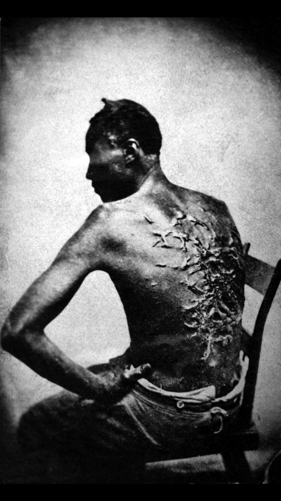 كم اتألم لأجل الافارقة السود الذين فقدو ارواحهم تحت تعذيب المستعبد الابيض عار اً فى تاريخ  امريكيا لايمحوه الزمن 💔💔💔