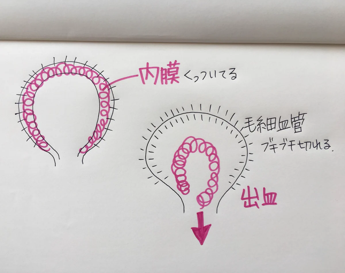 男子諸君よく聞け！！女性の生理って毎回毛細血管ブチブチ切れてるんだぞ！！