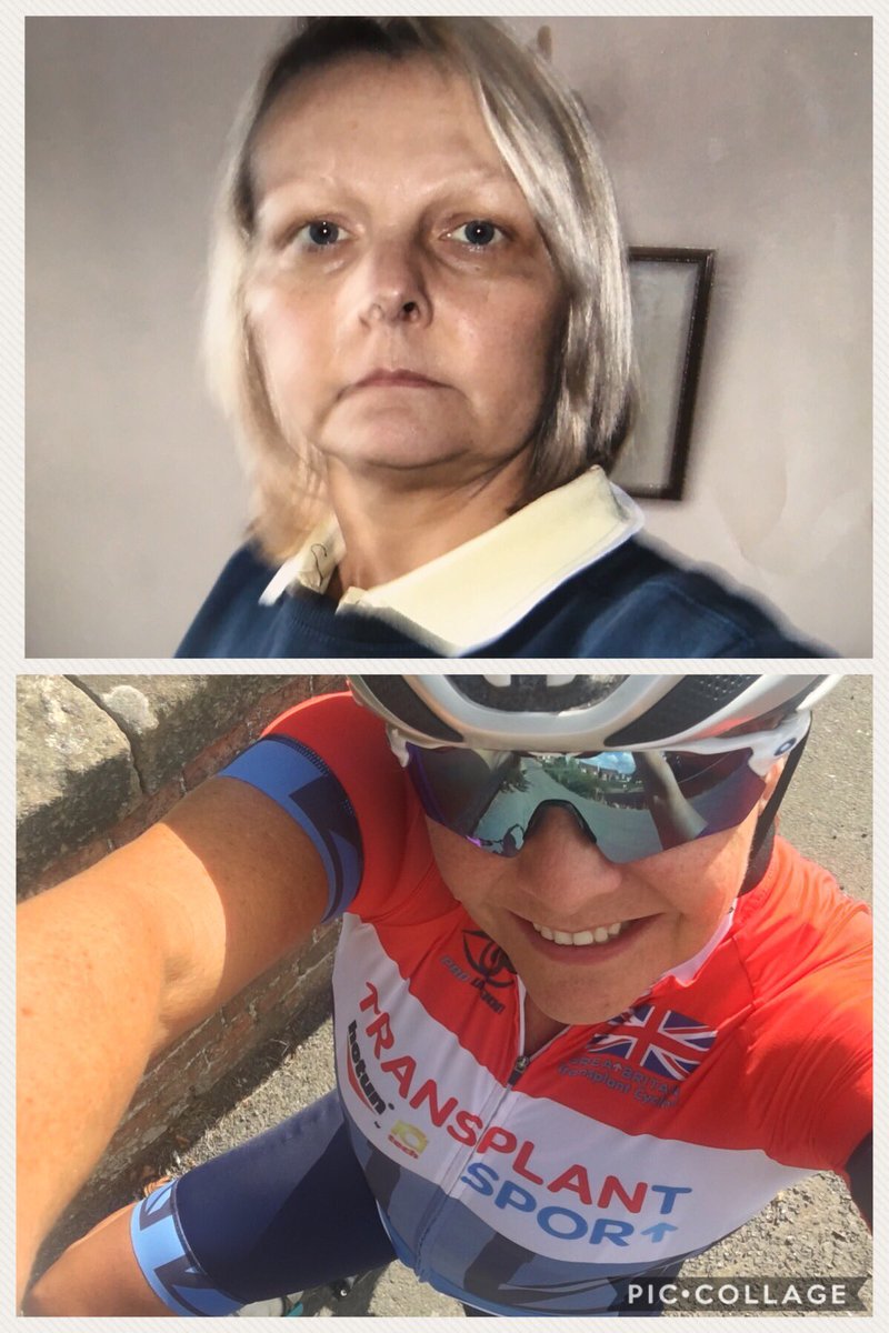 Organ Donor Week beings lets talk!!!! Nearly 10 years post transplant thanks to #Helen  <a href="/NHSOrganDonor/">NHS Organ Donation💗🫀🫁</a> <a href="/BBCDerby/">BBC Derby</a> <a href="/UHDBTrust/">University Hospitals of Derby and Burton NHS FT</a> <a href="/BhamTxSport/">Birmingham Adults Transplant Sport Team</a> <a href="/share_wishes/">Share Your Wishes</a> <a href="/DonorFamilyNetw/">DonorFamilyNetwork</a> @fraserbearbates @QEHBCharity
