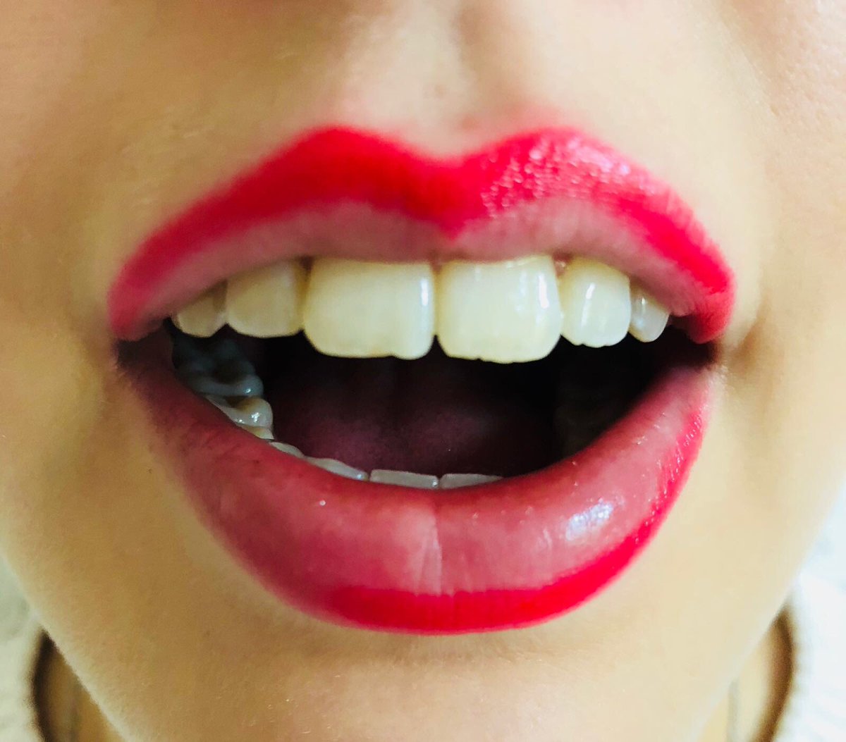 Ilovemysmile.de (@ilmysfrankfurt) on Twitter photo 
