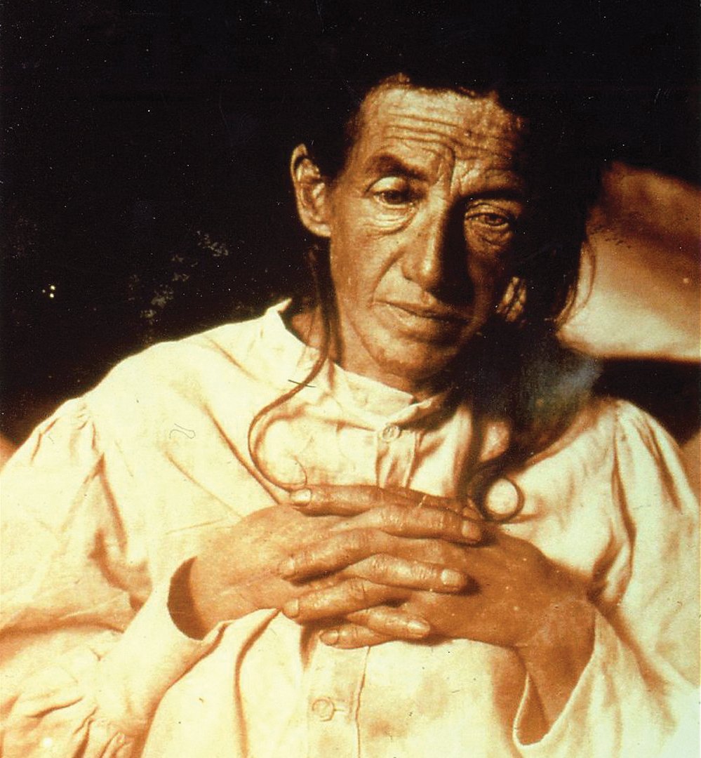 This is Auguste Deter. She was the first person to be diagnosed with Alzheimer's disease. Over 100 years later, we still wouldn’t be able to offer her a treatment to slow or stop the disease.

#WorldAlzMonth