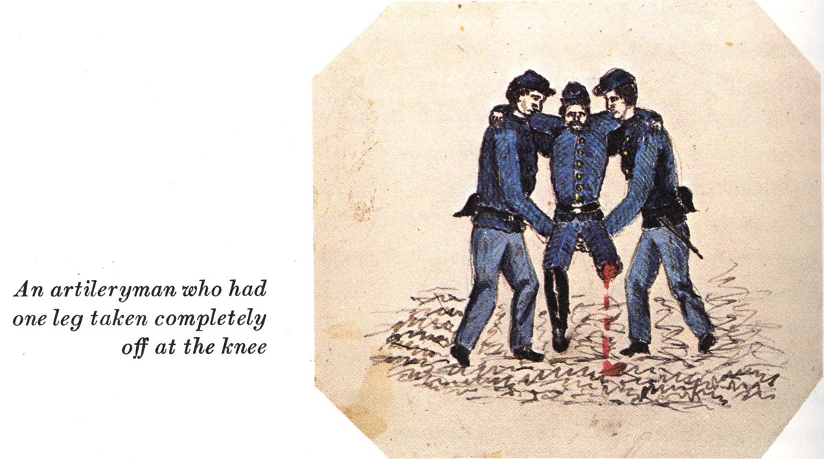 InvalidCorps's tweet photo. The Civil War Invalid Corps recruited over 60,000 men. Nearly 1,700 men died while in the Invalid Corps #theinvalid #theinvalidcorps #veteran #disabilitystrong #neverforget #disability #FightingSpirit #civilwar #americancivilwar #army #history #ushistory #smithsonian https://t.co/dACtZwAOV6