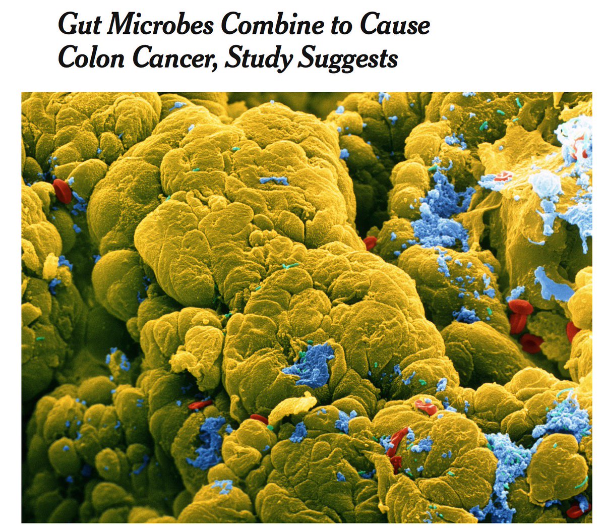 GraceSu63369816's tweet photo. Pretty bold headline, @markowenmartin #bio350 #mbionet #devilmicrobes https://t.co/5YPNKfIV4t https://t.co/52i0UGyAgT