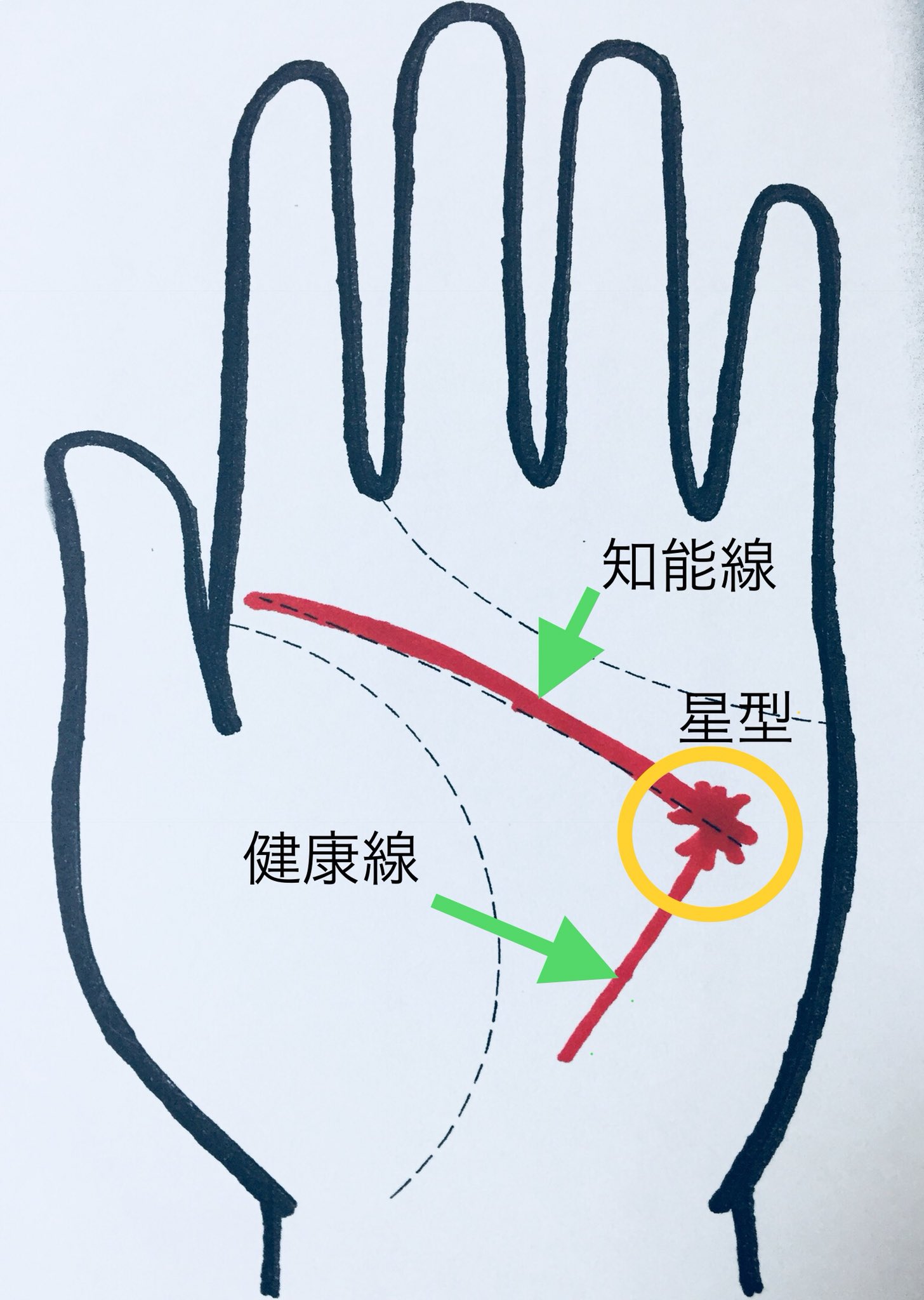 手相占い 華与 健康 性機能が低下の手相 健康線が知能線にぶつかり 星型マークが出てる場合 男女問わず 性機能が弱くなってる暗示 子宝に恵まれにくい状態 ただ絶対出来ないという意味ではない 健康 性機能が弱い 手相占い T Co