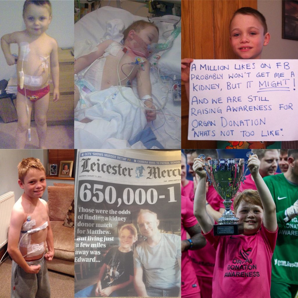 1MLikes4Matthew's tweet photo. It’s organ donation week please talk to your loved one about your wishes , Matthew is 1 of the lucky ones. He had a great family &amp; friend supporting him after spending 8 yrs on dialysis he’s now living the dream ❤️❤️❤️ https://t.co/34Tht5kFbg