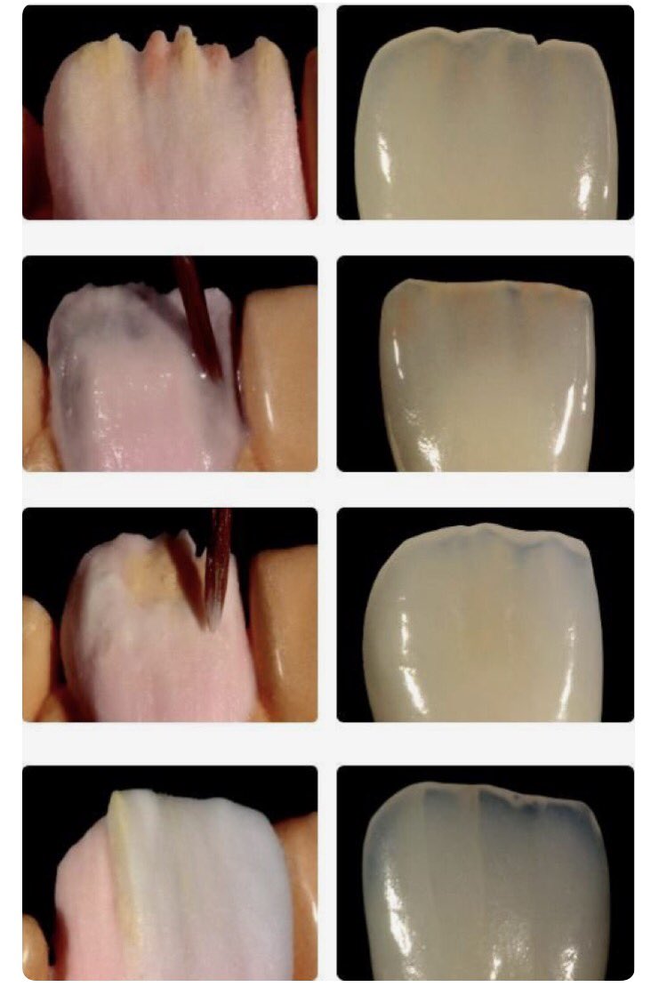 Dentagama's tweet photo. Ceramic layering and staining at the dental lab https://t.co/nOSDqDtDaC