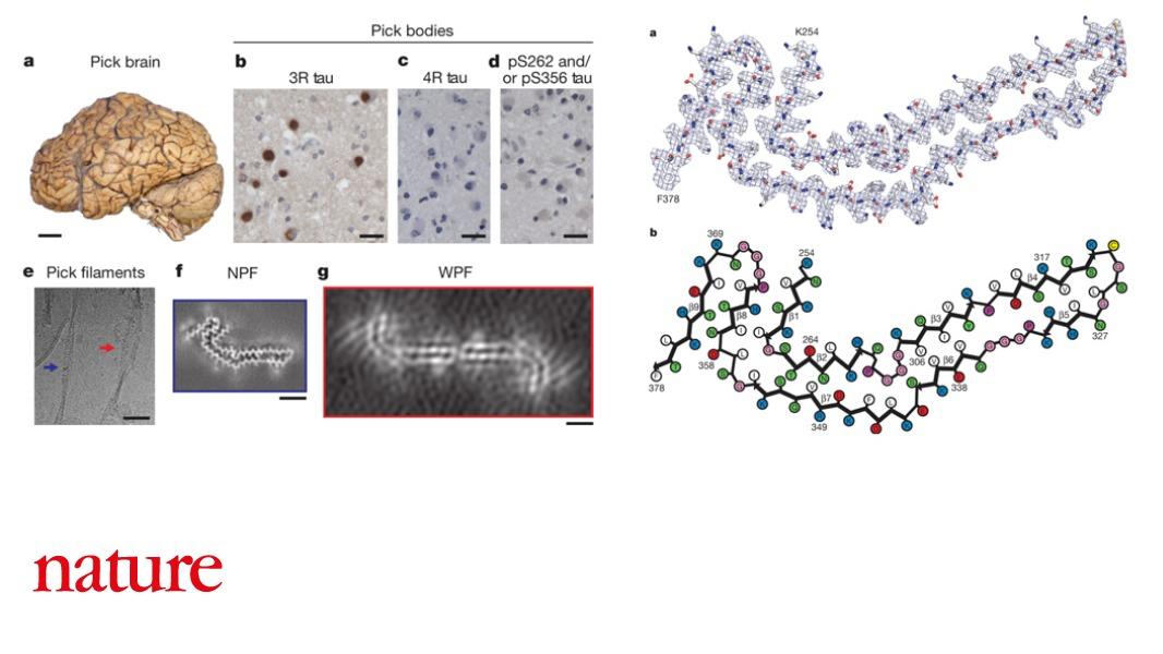 Nature The structure of tau protein filaments in Pick’s disease (a