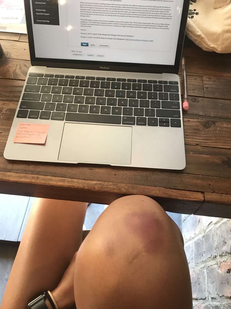 DLeksingto's tweet photo. Got this gift from Ezoo! 🤕 https://t.co/H0aRfWOnBf