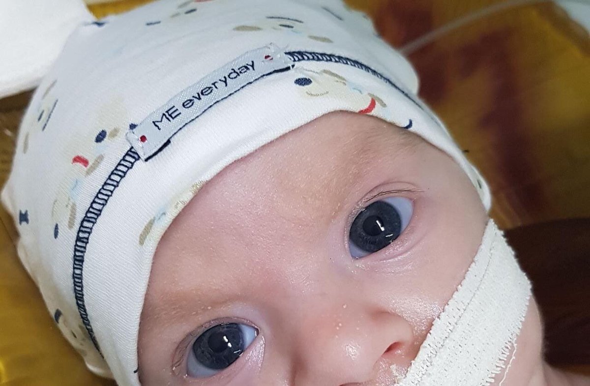 Mercedestessio's tweet image. ☝🏻 El es Manu. Un bebé que tiene atrofia muscular espinal @SwissMedicalG  no le cubre el tratamiento! 🙏🏼

Por favor RT para que #SwissMedical se haga cargo! 
#TodosPorManu