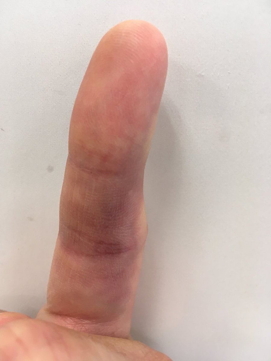 Old Man Basketball tweet media