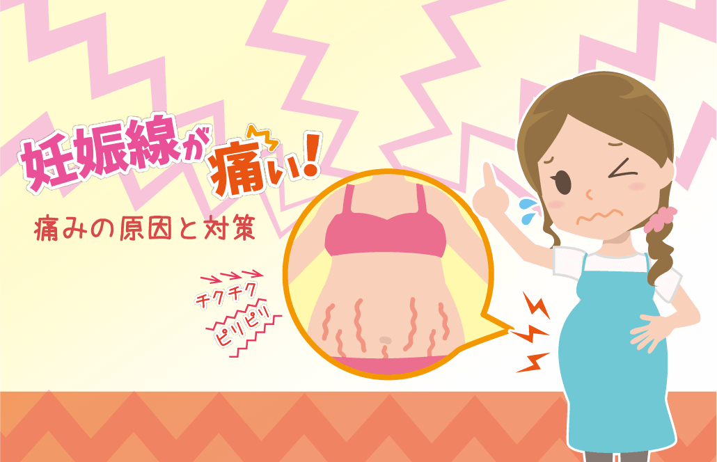 妊娠線の痛み